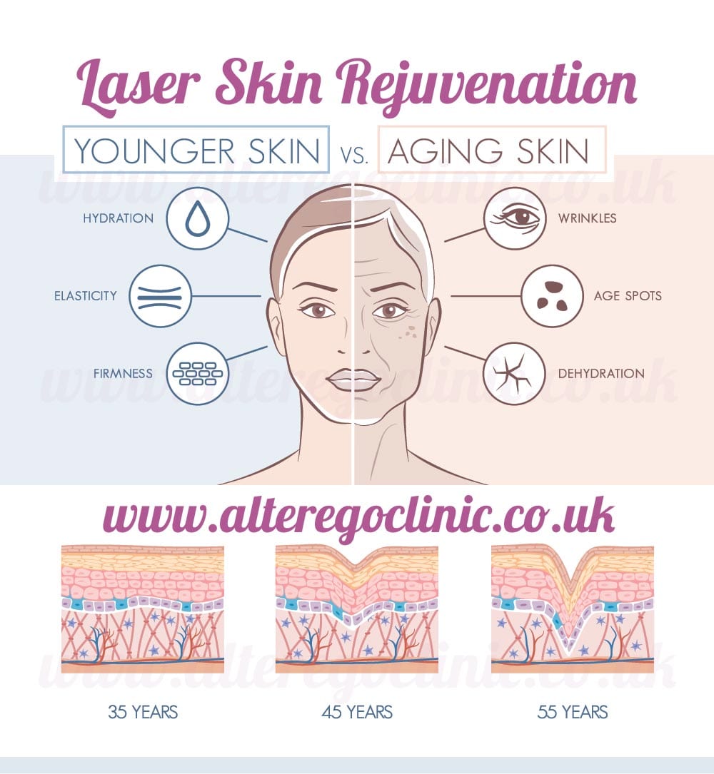 Photo Rejuvenation Laser Skin Rejuvenation Alter Ego Beauty Clinic