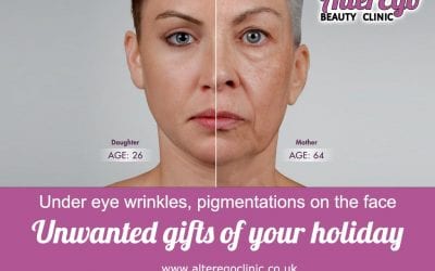 Under eye wrinkles, pigmentations on the face. Unwanted gifts of your holiday-part 1